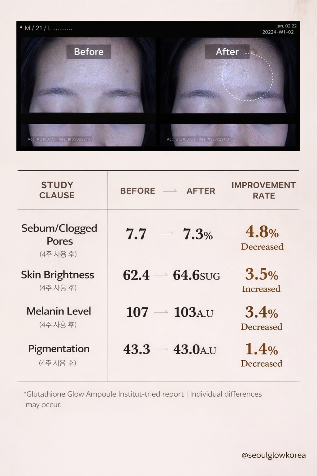Medicube Glutathione Glow Ampoule Clinical Results | Brightening & Pigmentation Care Serum | K-Beauty Authentic
