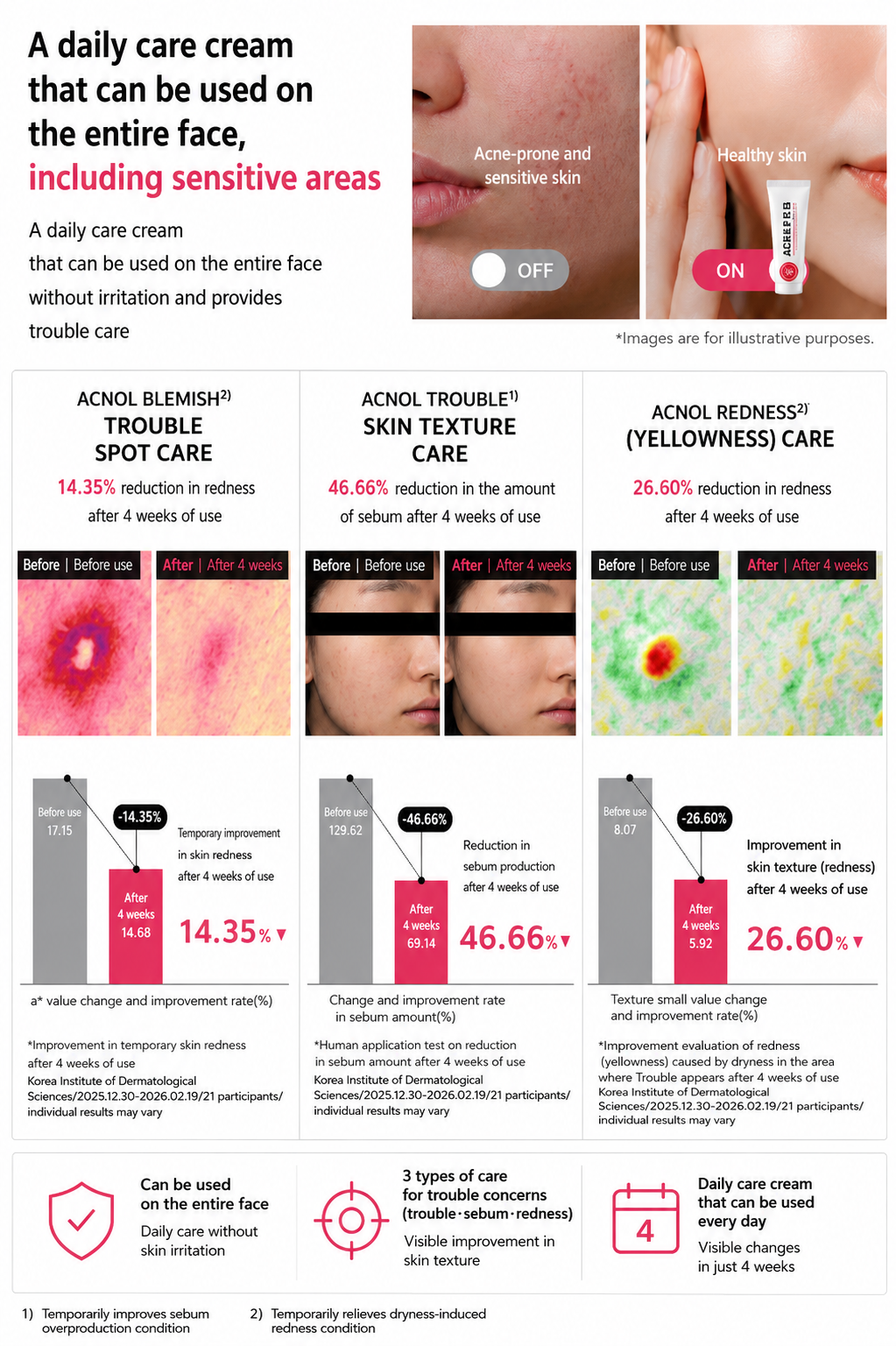 Dong-A Pharmaceutical Acnol Pro Daily Trouble Care Cream 30ml