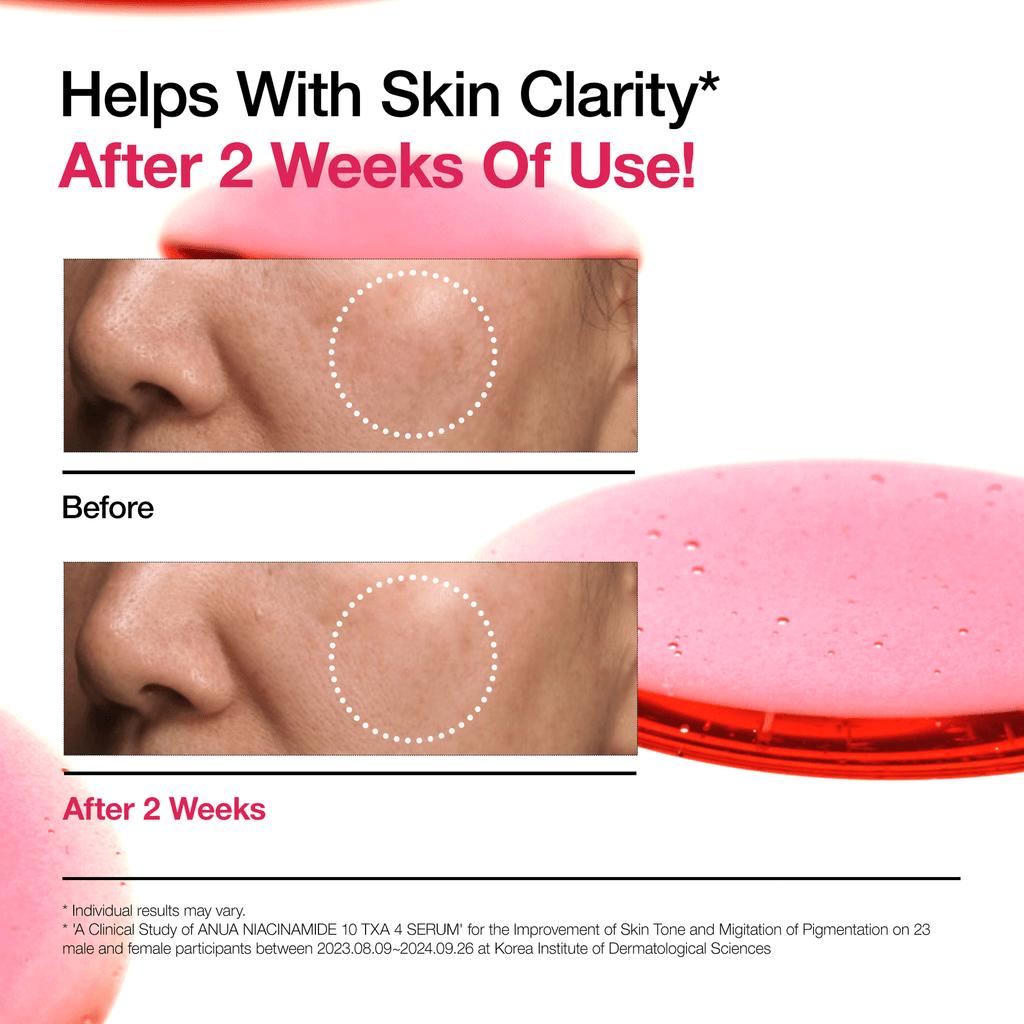 AUNA Niacinamide 10% + TXA 4% Dark Spot Correcting Serum