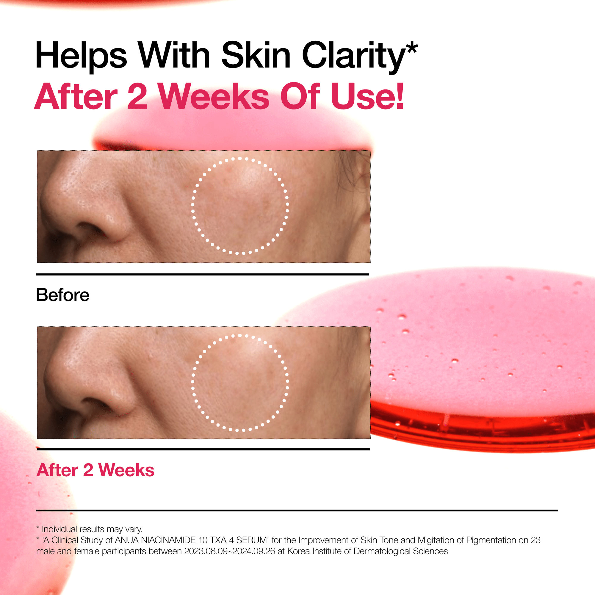 AUNA Niacinamide 10% + TXA 4% Dark Spot Correcting Serum