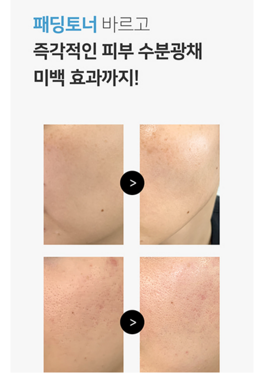 Padding Toner | Deep Hydration & Skin Barrier Strengthening Care
패딩 토너 | 깊은 보습 & 피부 장벽 강화 탄력 케어 500ml