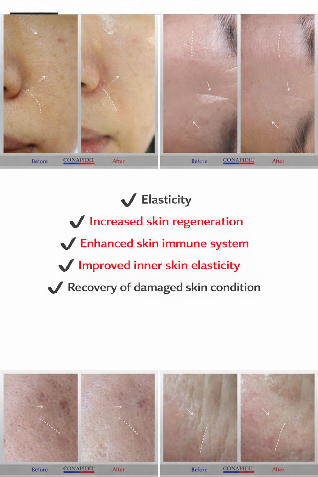Cemenzal Light High Potency Cream 0.95g x 8EA – Intensive Repair & Skin Regeneration Cream