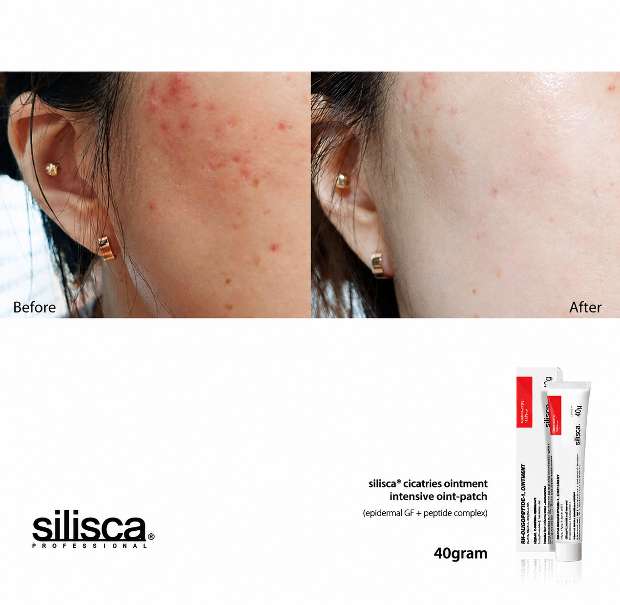 Silisca Cicatries Ointment 40g Intensive Skin Recovery Cream
