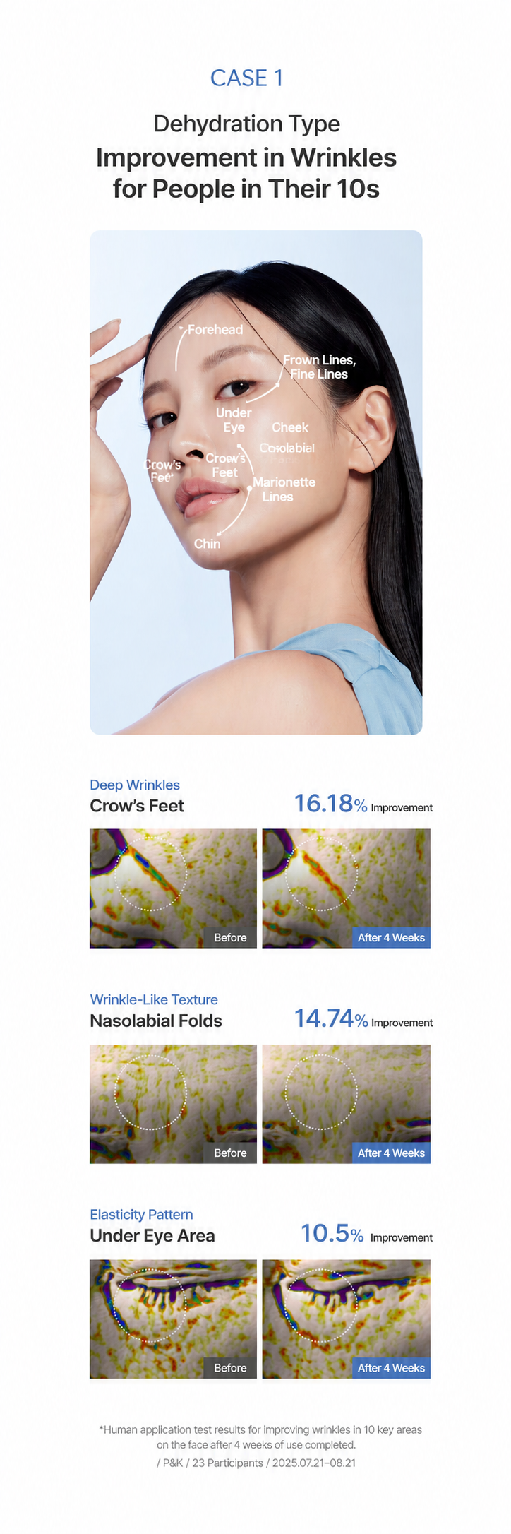 [Arocell] Botulcare Prime Tox Mask (2 Sheets)