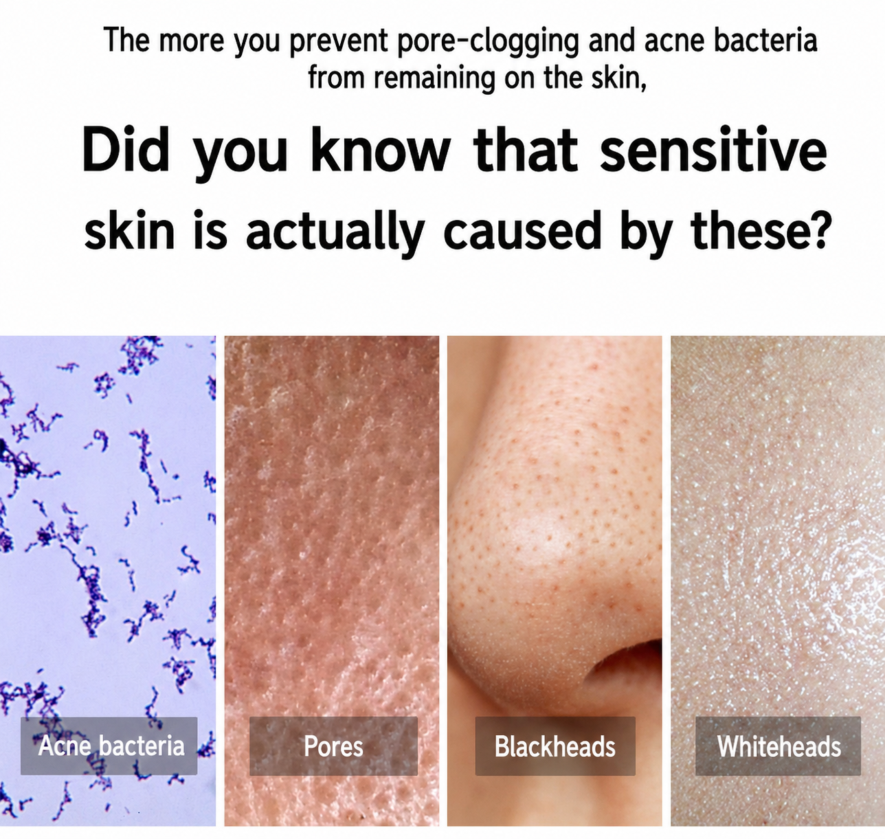 Dong-A Pharmaceutical Acne PRO Gel for Acne-Prone & Sensitive Skin 30ml