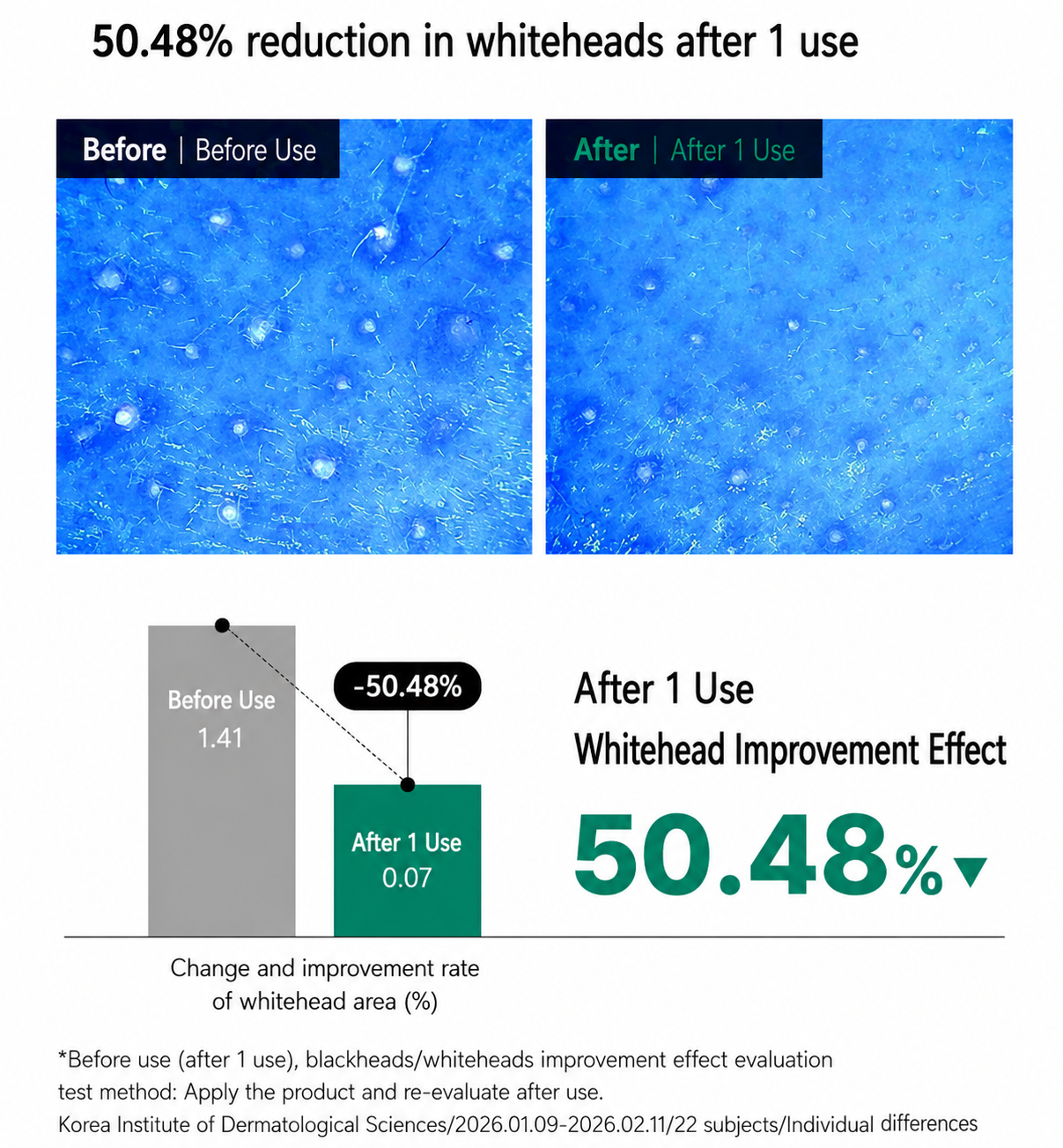 Dong-A Pharmaceutical Acne PRO Gel for Acne-Prone & Sensitive Skin 30ml