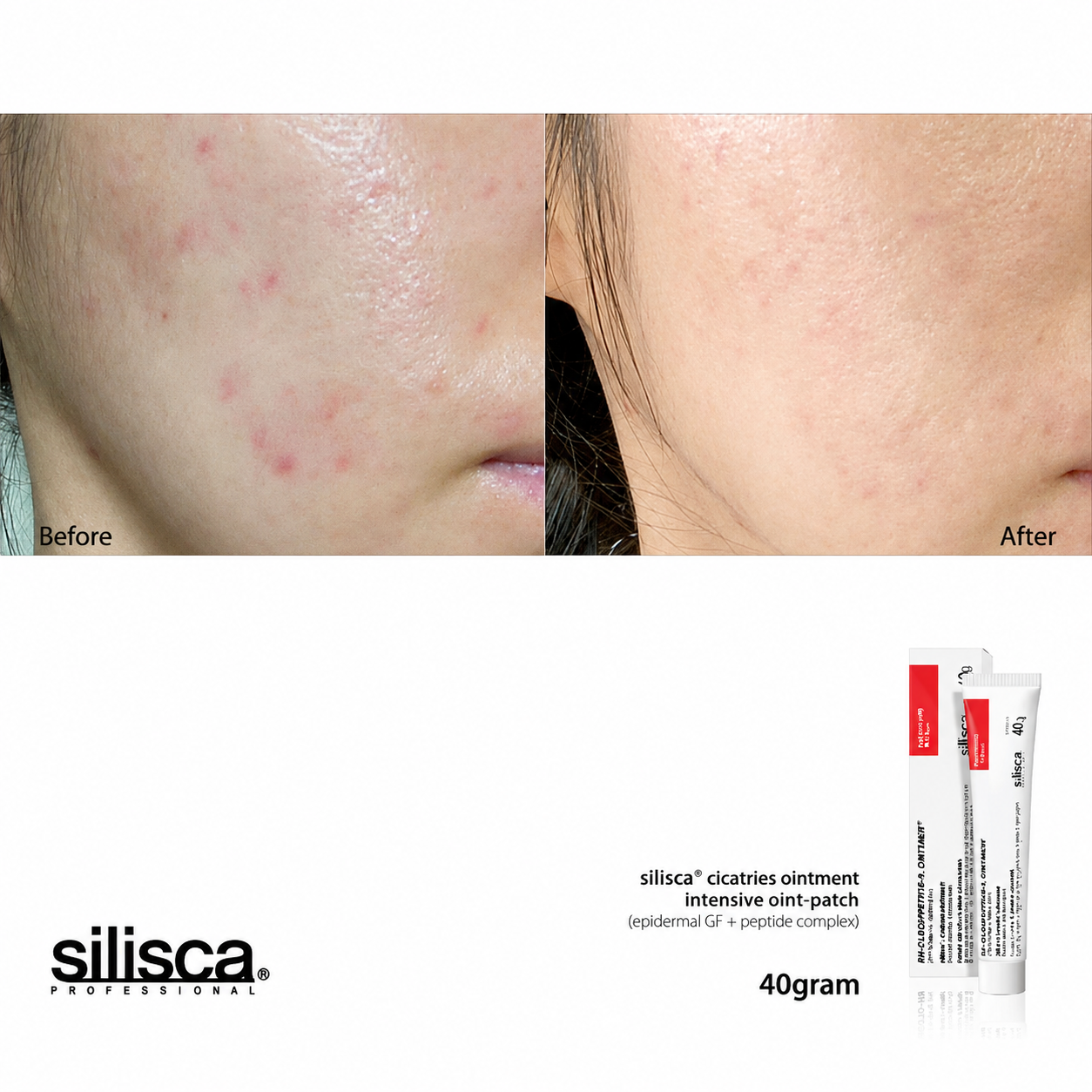 Silisca Cicatries Ointment 40g Intensive Skin Recovery Cream