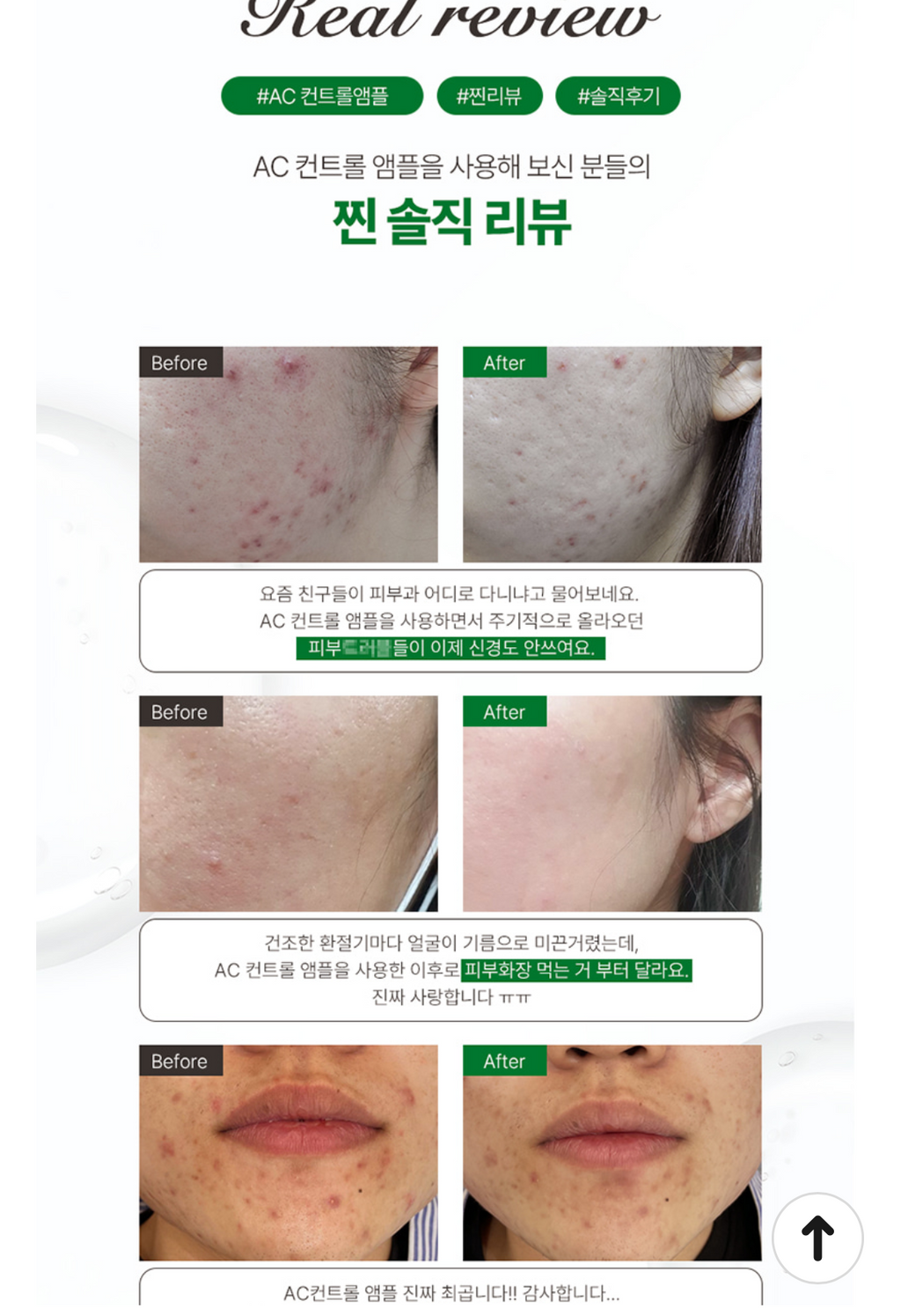 AC Control Ampoule | Acne Care, Sebum Balance & Soothing Treatment AC 컨트롤 앰플 | 여드름 피부 진정 & 피지 밸런스 케어