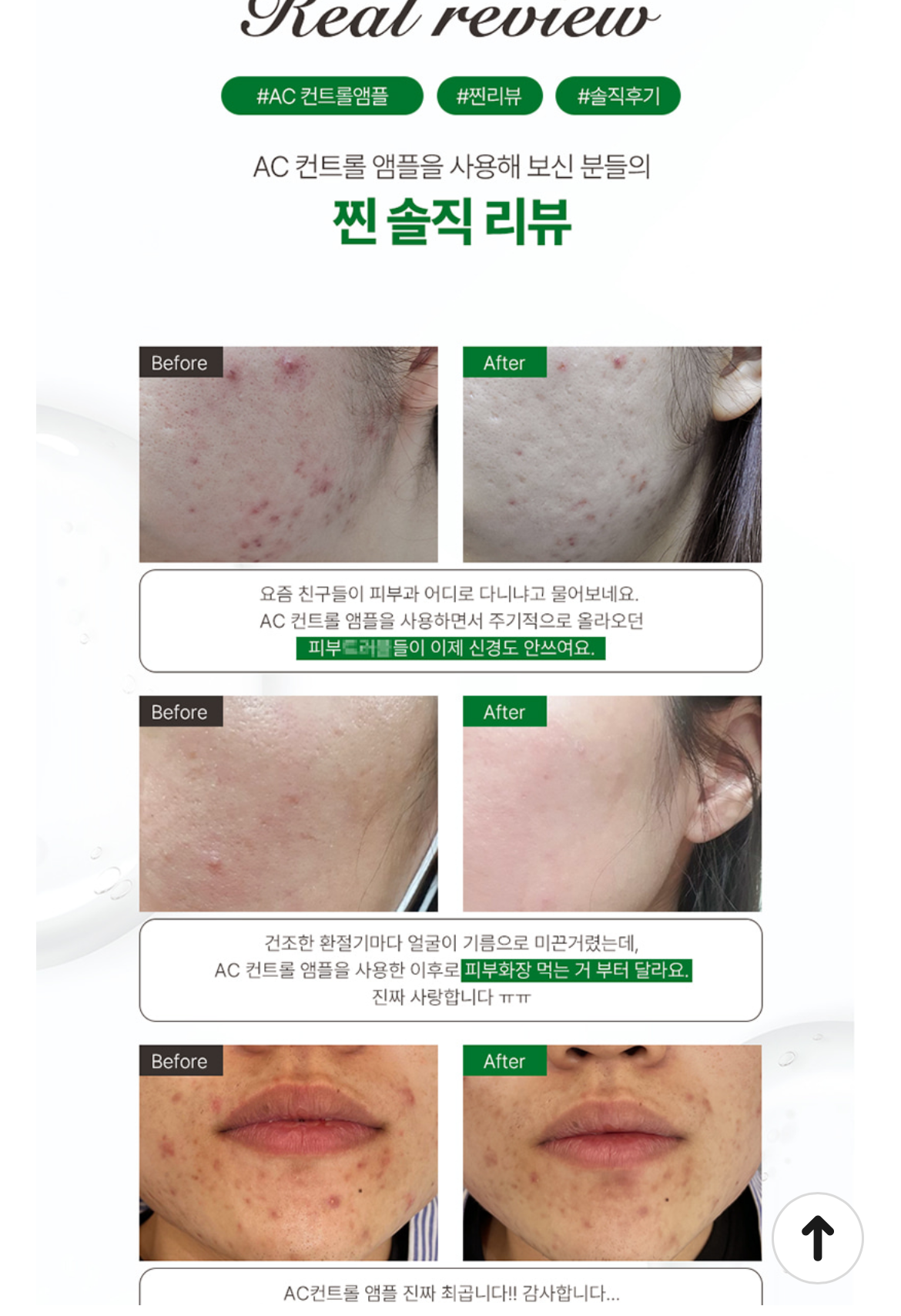 AC Control Ampoule | Acne Care, Sebum Balance & Soothing Treatment AC 컨트롤 앰플 | 여드름 피부 진정 & 피지 밸런스 케어
