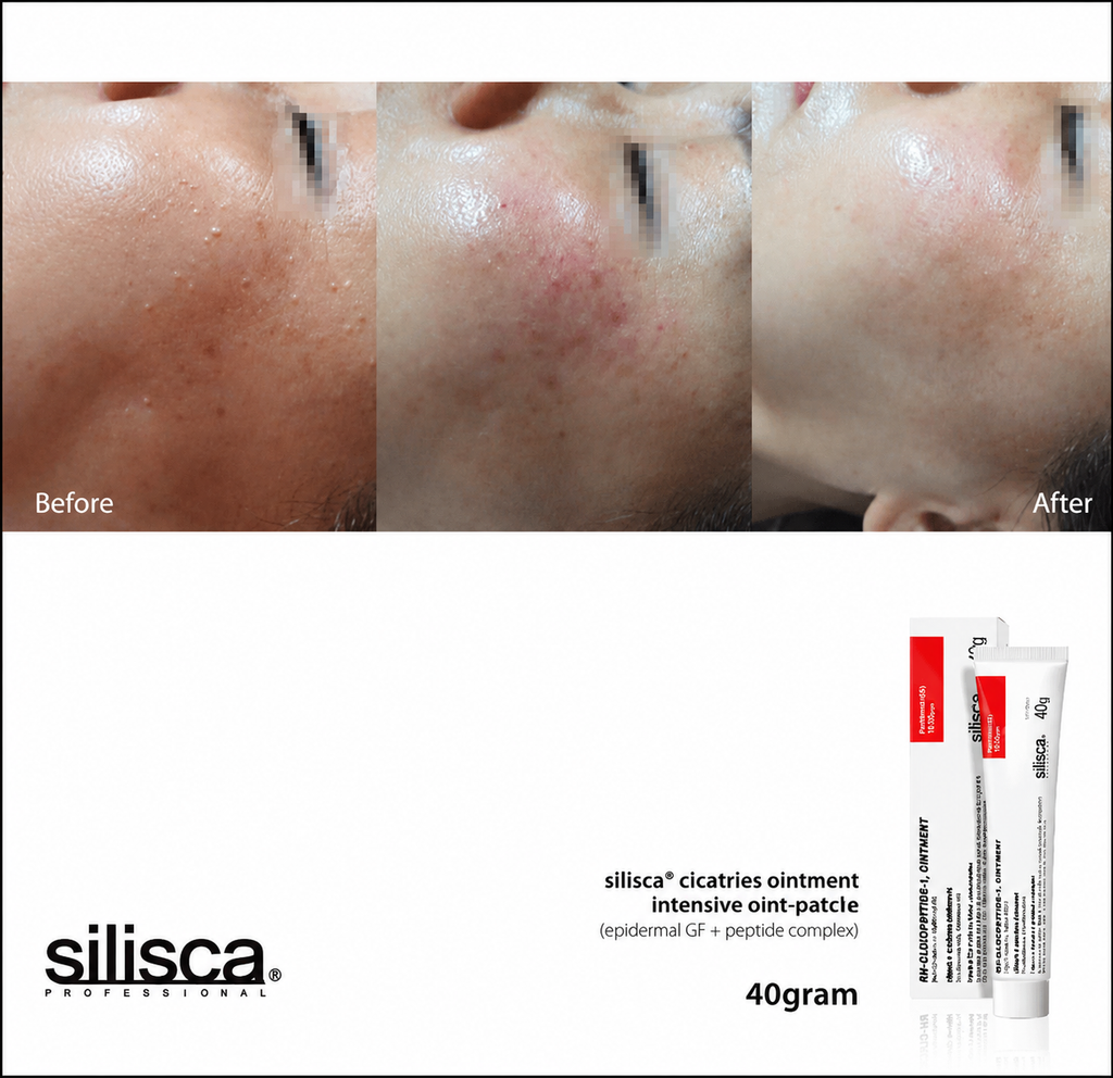 Silisca Cicatries Ointment 40g Intensive Skin Recovery Cream