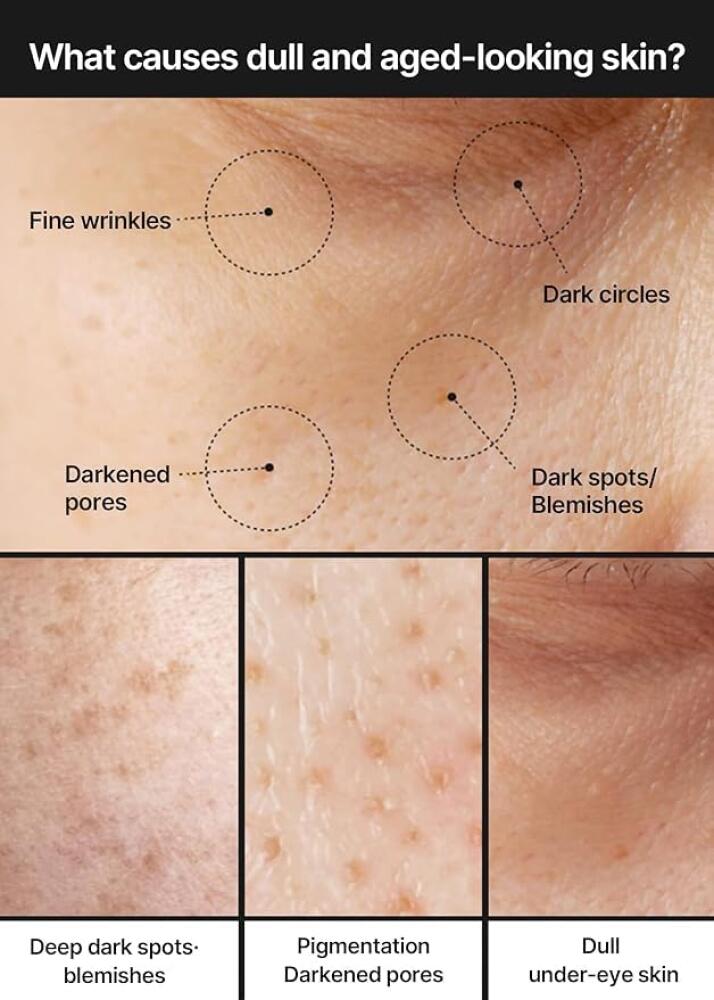 celimax Pore + Dark Spot Brightening Cream 35ml | Niacinamide TXA Cream for Even Skin Tone