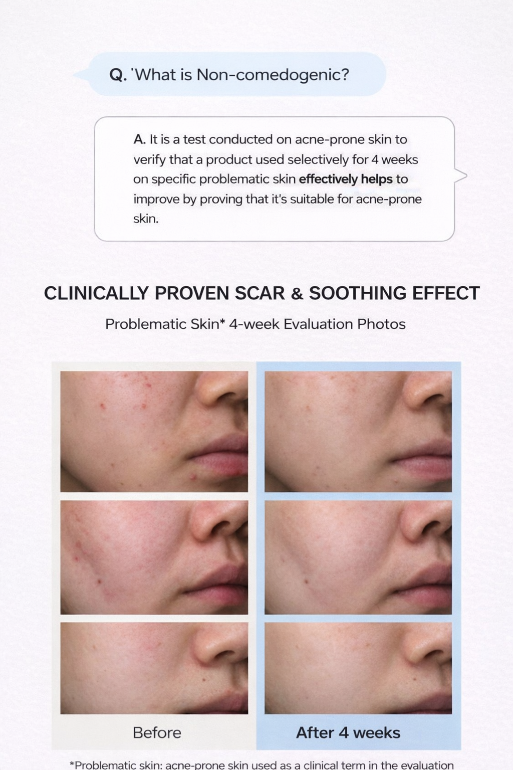 Dr. Althea 345 Relief Cream 50ml – Acne Care, Soothing & Scar Repair